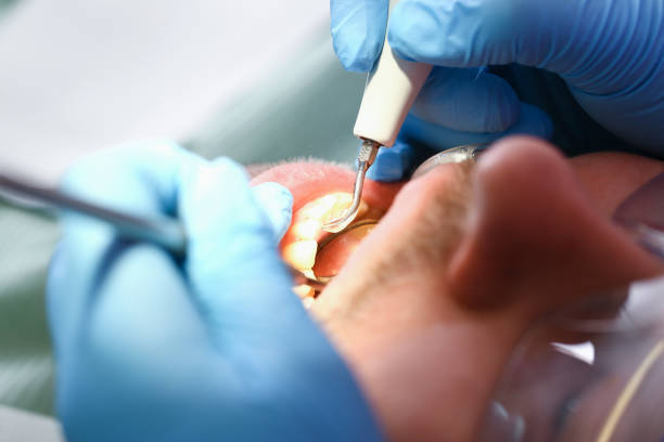 Best Cracked Tooth Emergency Dentist  in Florin, CA