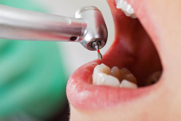 Best Broken Tooth Emergency  in Florin, CA